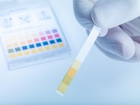 Hand iført handske tester en strimmel med et pH-farvekort